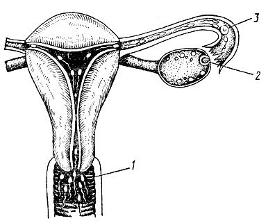 Рис. 9. Процесс оплодотворения яйцеклетки сперматозоидом в маточной трубе: 1 - влагалище; 2 - яичники; 3 - яйцеклетка
